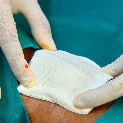 How To Heal Chronic Wounds A Guide To Effective Treatments