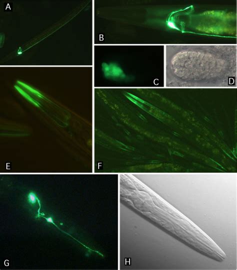 Gfp Expression Patterns Driven By Promoterome Reporter Gene Fusions