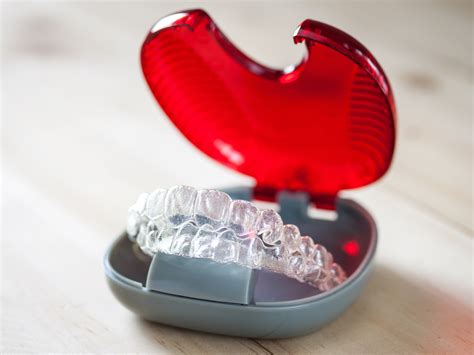 Invisalign Retainers What Ksa Conference