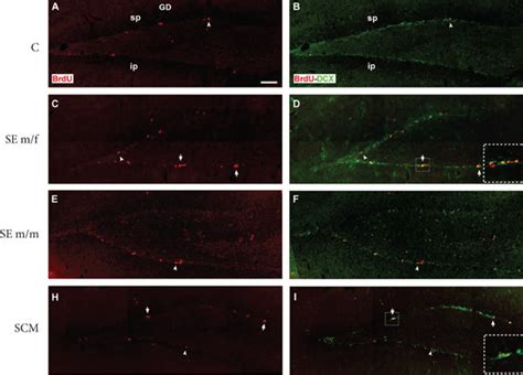 Representative Photomicrographs Of Immunolabeling For Brdu Red A C