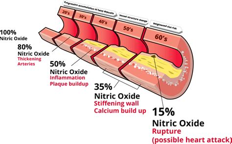 Low Nitric Oxide Level Symptoms | NutriSpec.net