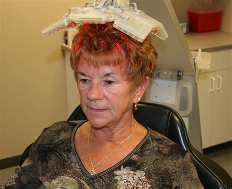 Radiation Therapy: Radiation Therapy Hair Loss