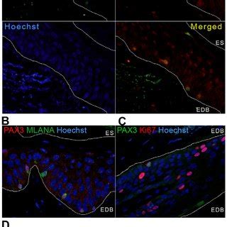 Co Expression Analysis Of PAX3 Positive Epidermal Melanocytes Of Normal