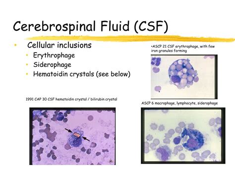 Ppt Urinalysis And Body Fluids Crg Powerpoint Presentation Free