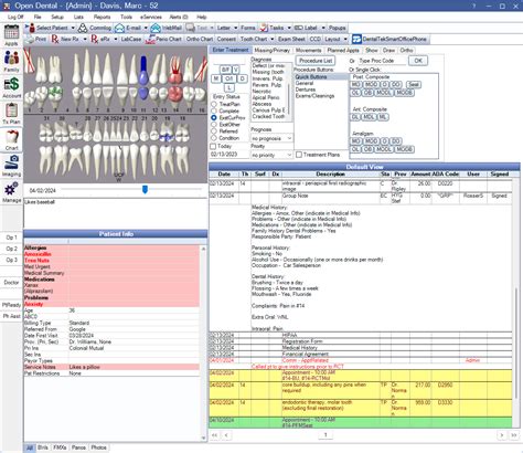 Open Dental Software Chart Module