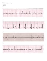 EKG Packet Docx 1 EKG ECG Worksheet Note All Strips Are Six Second