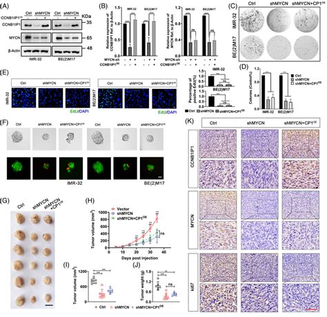 CCNB1IP1 Promotes NB Cell Proliferation And Tumour Growth In A