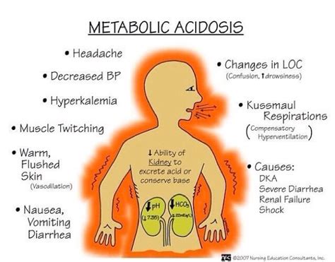 Metabolic Acidosis Nursing School Flash Card Nursing School Studying