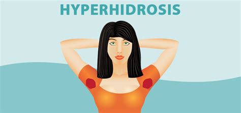 Hyperhidrosis – Causes, Symptoms, Diagnosis, And Treatment ...