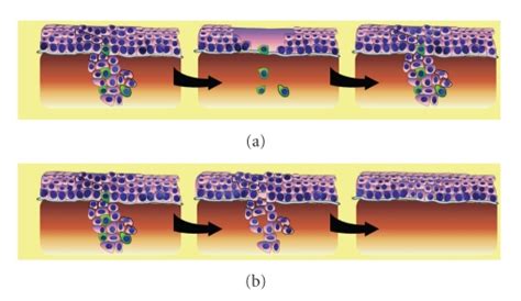 Csc Theory And Treatment Response A Current Chemotherapy And