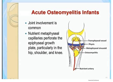 Solution Patho Osteomyelitis Studypool