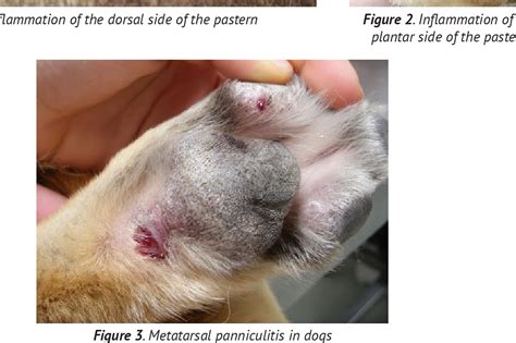 Figure 1 From Clinical Manifestation And Methods Of Treatment Of