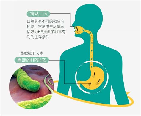 拒绝病从口入，用对了牙膏，省下的钱令人咋舌！财经头条