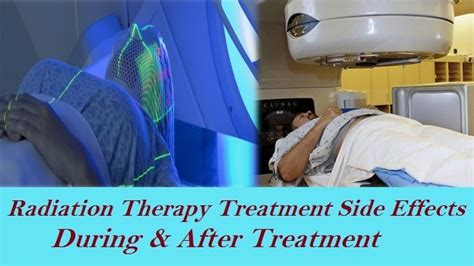 Radiation Therapy Treatment Side Effects During and After Treatment