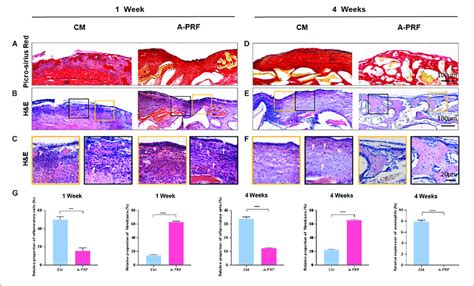 Histological And Histomorphometric Analysis Of Soft Tissue Healing