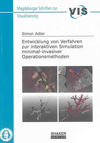 Entwicklung Von Verfahren Zur Interaktiven Simulation Minimal Invasiver