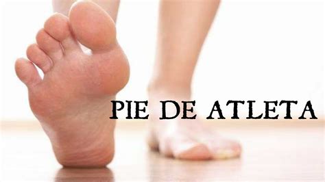 Pie De Atleta Te Explicamos Como Prevenirlo Salud Diez