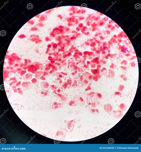 Diplococci Gram Positive