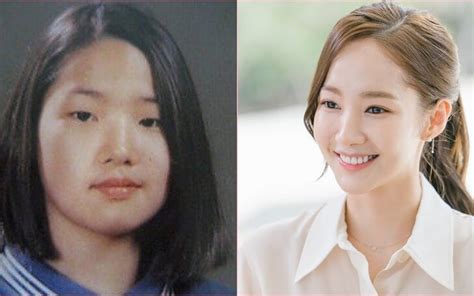 Full Story on Park Min-young's Plastic Surgery