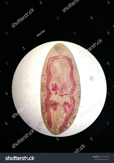 Parasitology Slide Adult Paragonimus Westermani Stock Photo Edit Now