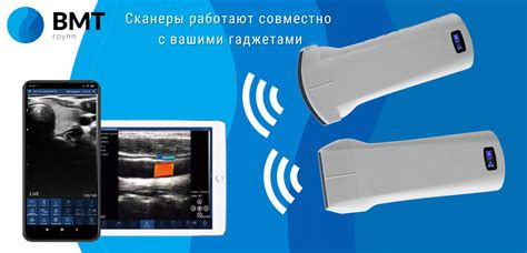 Беспроводной УЗИ сканер WiFi датчик Uprobe-C5PL – купить | Беспроводной ...