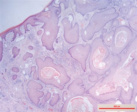 Histopathology Hematoxylin Eosin He Staining Of The Differentiated