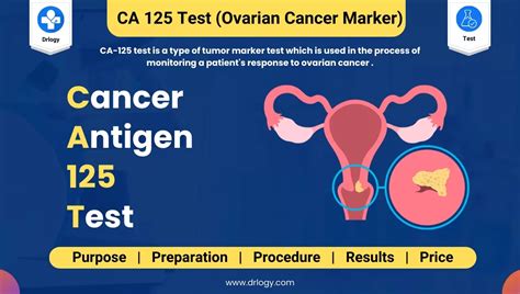 Ca 125 Cancer Antigen 125 Test Price And Normal Range Drlogy