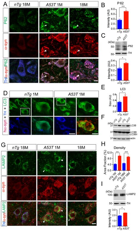 Over Expression Of Syn Alters Autophagosome And Lysosome Marker