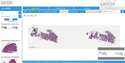 10 Open Source Whole Slide Image Viewers And Analysis Programs