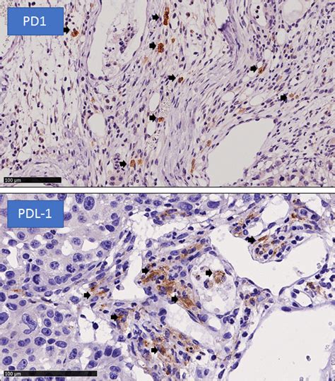 Pd Pdl Immunostaining For Tumoral Preclinical Models Atlantic