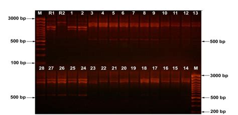 The Rapd Pcr Profiles Of Ort Isolates M Bp Dna Marker And