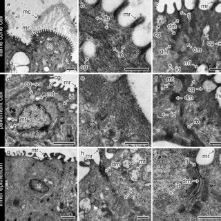 schematic diagram  seahorse brood pouch  seahorses body