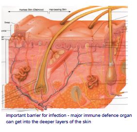 Skin Soft Tissue And Bone Infections Flashcards Quizlet