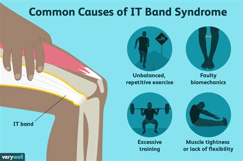 Iliotibial IT Band Syndrome Causes Treatment And When To See A