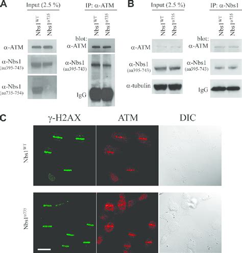 Dna Damage Induced Atm Nbs1 Interaction And Recruitment Of Atm To Dna