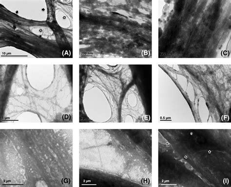 Transmission Electron Micrographs Of Human Dermal Fibroblasts Hdfs