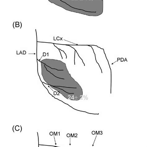 figure positions  coronary artery ligation  ligation
