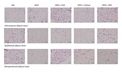 Histology Of Adipose Tissues In HFD Induced Obese Mice A