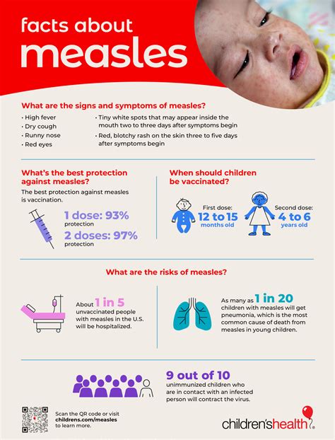 Symptoms Of Measles