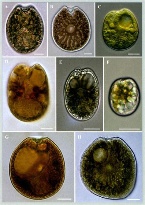 Marine Benthic Dinoflagellates