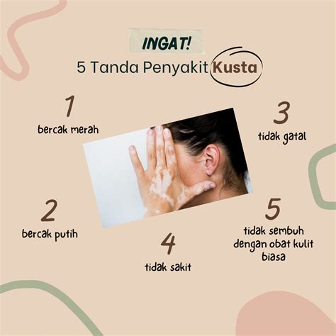 Kusta Bukan Kutukan Begini Cara Penanganan Yang Tepat Anggi Putri