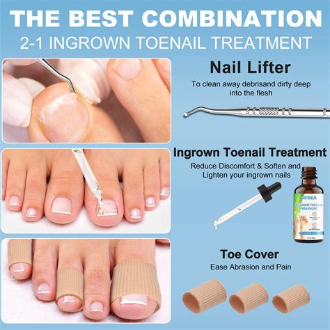 10 Best Products for Ingrown Fingernail Relief in 2024
