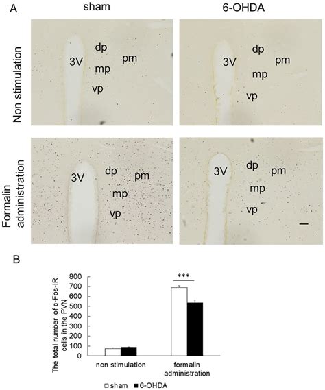 Immunohistochemical Labeling For C Fos In The Pvn A Photomicrographs