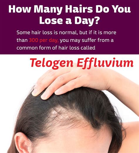 Telogen Effluvium Hpi Hair Partners Nashville Diffuse Thinning Hair Loss Male Pattern Baldness