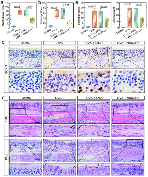 Silencing Sox11 Attenuated Allergic Symptoms Of Ar Mice A B Number