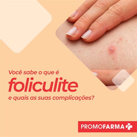 Você sabe o que é foliculite e quais as suas complicações Promofarma