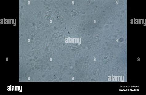 Cheese bacteria Stock Videos & Footage - HD and 4K Video Clips - Alamy