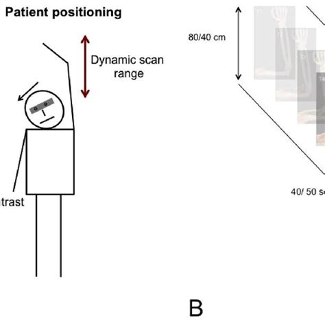 Schematic Overview Of The Time Resolved Dynamic Ct Angiography Scan Download Scientific Diagram