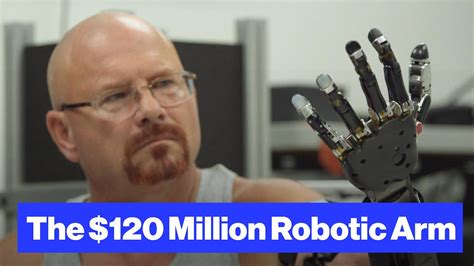 The Robot-Arm Prosthetic Controlled by Thought - Go IT