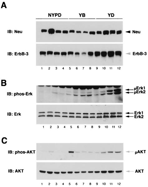 Activation Of Erk And Akt Phosphorylation In Yb And Ydderived But Not